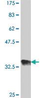 Anti-EPC1 Mouse Polyclonal Antibody