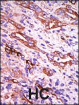 Anti-GRK1 Rabbit Polyclonal Antibody (PE (Phycoerythrin))