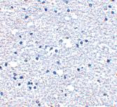 Anti-PD1 Rabbit Polyclonal Antibody