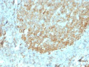 Immunohistochemical analysis of formalin-fixed, paraffin-embedded human tonsil using Anti-MALT1 Antibody [rMT1/410]