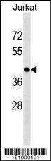 Anti-HLA-C Rabbit Polyclonal Antibody (AP (Alkaline Phosphatase))