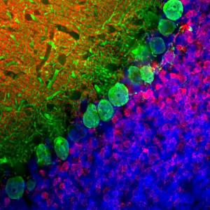 Anti-Calbindin Mouse Monoclonal Antibody [clone: 4H7]