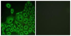 Immunofluorescence analysis of A549 cells using Anti-GPR153 Antibody. The right hand panel represents a negative control, where the Antibody was pre-incubated with the immunising peptide