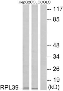 Western blot analysis of lysates from COLO and HepG2 cells using Anti-RPL39 Antibody. The right hand lane represents a negative control, where the antibody is blocked by the immunising peptide