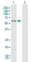 Anti-GTF2E1 Rabbit Polyclonal Antibody