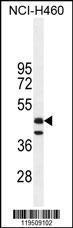 Anti-FGL2 Rabbit Polyclonal Antibody (AP (Alkaline Phosphatase))