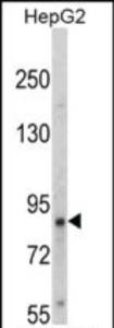 Anti-NTRK1 Rabbit Polyclonal Antibody