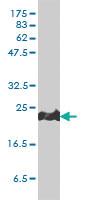 Anti-PRDX1 Mouse Monoclonal Antibody [clone: 4B11-D10]