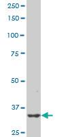 Anti-PBK Mouse Monoclonal Antibody [clone: 1E11]