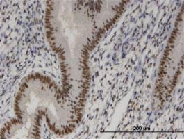 Anti-SIX4 Mouse Monoclonal Antibody [clone: 3B8]