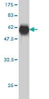 Anti-CTDSP2 Mouse Monoclonal Antibody [clone: 4F4]