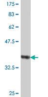 Anti-NCOA3 Mouse Polyclonal Antibody