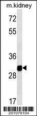 Anti-GNPDA1 Mouse Monoclonal Antibody (APC (Allophycocyanin)) [clone: 237CT2.5.2]