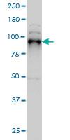 Anti-SIX4 Mouse Monoclonal Antibody [clone: 5E1]