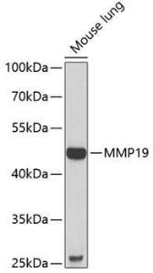 Anti-MMP19 Rabbit Polyclonal Antibody