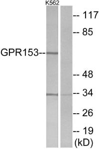 Western blot analysis of lysates from K562 cells using Anti-GPR153 Antibody. The right hand lane represents a negative control, where the Antibody is blocked by the immunising peptide