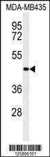 Anti-CC50B Rabbit Polyclonal Antibody (AP (Alkaline Phosphatase))