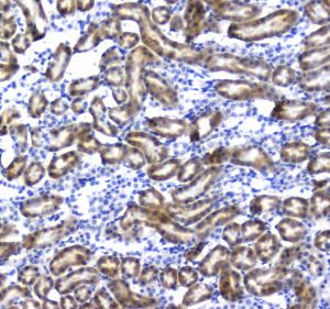 Anti-Regucalcin Polyclonal Antibody