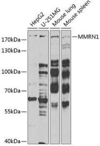 Western blot analysis of extracts of various cell lines, using Anti-ECM Antibody (A9957) at 1:1,000 dilution The secondary antibody was Goat Anti-Rabbit IgG H&L Antibody (HRP) at 1:10,000 dilution Lysates/proteins were present at 25 µg per lane