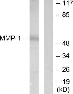 Anti-MMP-1 antibody