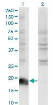 Anti-ARF6 Mouse Monoclonal Antibody [clone: 2A4]