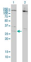 Anti-BCL7B Mouse Monoclonal Antibody [clone: 6D2]