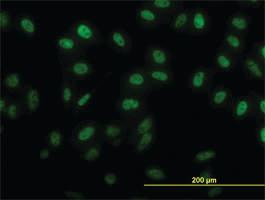 Anti-SIX4 Mouse Monoclonal Antibody [clone: 5E1]