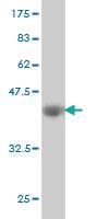 Anti-EVL Mouse Monoclonal Antibody [clone: 5G1]