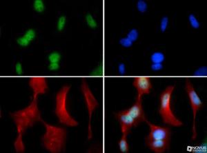 Anti-PIEZO2 Rabbit Polyclonal Antibody (DyLight® 488)