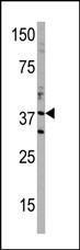 Anti-DIMT1 Rabbit Polyclonal Antibody (PE (Phycoerythrin))