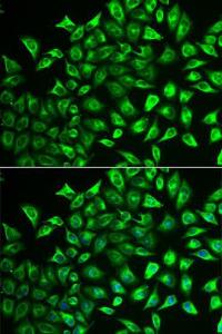 Immunofluorescence analysis of U2OS cells using Anti-ECM Antibody (A9957) DAPI was used to stain the cell nuclei (blue)