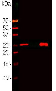 Anti-Calbindin Mouse Monoclonal Antibody [clone: 4H7]