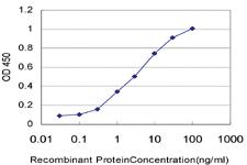 Anti-SIX4 Mouse Monoclonal Antibody [clone: 5E1]