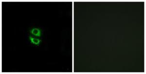 Immunofluorescence analysis of A549 cells using Anti-RPL39 Antibody. The right hand panel represents a negative control, where the antibody was pre-incubated with the immunising peptide