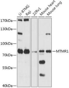 Western blot analysis of extracts of various cell lines, using Anti-MTMR1 Antibody (A305455) at 1:1,000 dilution The secondary antibody was Goat Anti-Rabbit IgG H&L Antibody (HRP) at 1:10,000 dilution Lysates/proteins were present at 25 µg per lane