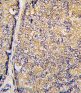 Anti-STAP1 Rabbit Polyclonal Antibody (FITC (Fluorescein))