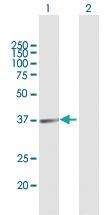 Anti-ARG1 Mouse Polyclonal Antibody