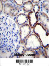 Anti-NKD2 Rabbit Polyclonal Antibody (FITC (Fluorescein Isothiocyanate))