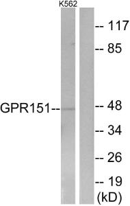 Anti-GPCR 2037 Rabbit Polyclonal Antibody