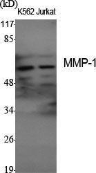 Anti-MMP-1 antibody