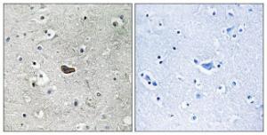 Immunohistochemical analysis of paraffin-embedded human brain tissue using Anti-PKC delta Antibody. The right hand panel represents a negative control, where the antibody was pre-incubated with the immunising peptide