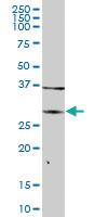 Anti-ARG1 Mouse Polyclonal Antibody