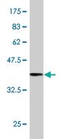 Anti-SYNJ2 Mouse Monoclonal Antibody [clone: 2B11]