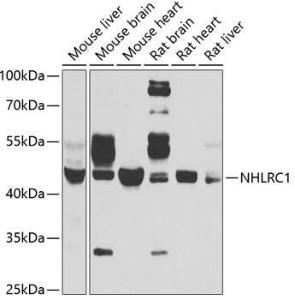 Anti-NHLRC1/Malin Rabbit Polyclonal Antibody