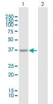 Anti-ARG1 Rabbit Polyclonal Antibody