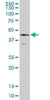 Anti-SERPINE1 Mouse Polyclonal Antibody