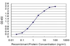 Anti-SIX4 Mouse Monoclonal Antibody [clone: 5D4]