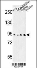 Anti-DPP10 Rabbit Polyclonal Antibody (APC (Allophycocyanin))