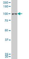 Anti-SIX4 Mouse Monoclonal Antibody [clone: 7E2]