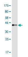 Anti-EVL Mouse Monoclonal Antibody [clone: 1D6]